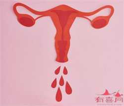 广州代生包成功多少钱，有卵巢囊肿可以做人工授精吗