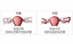 广州代怀包出生流程，孕晚期常摸肚子致早产？