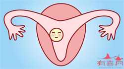 广州代生妈妈哪里找，卵巢癌年轻化！年轻女性应定期检查