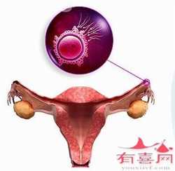广州供卵生儿子~广州借卵试管的案例~广州有知名度的供卵试管，早产儿急于长