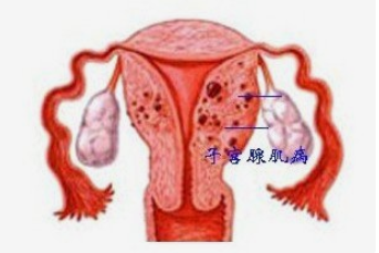 广州有供卵医院吗~广州哪里做供卵试管~，大寒出生的宝宝好吗？答案在此