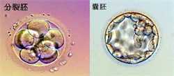 广州供卵试管婴儿周期,广州六院做供卵试管婴儿费用大约多少钱？5万够吗？