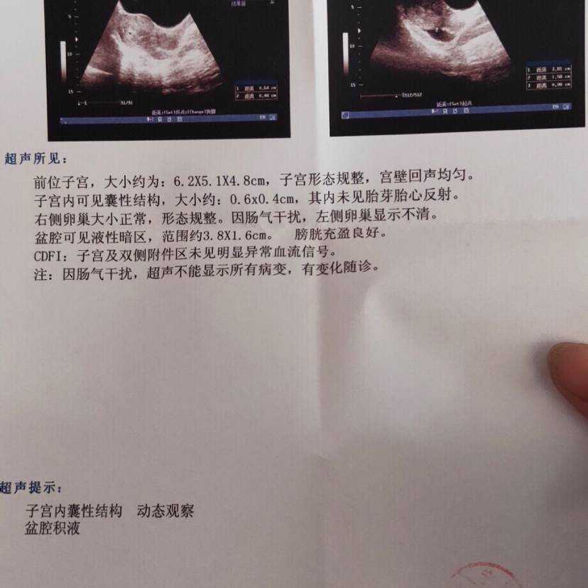广州南宁借卵生子有吗,北海试管婴儿医院北海有做试管婴儿的医院吗