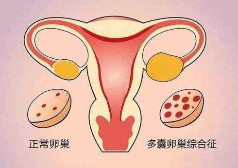 广东高龄女人借卵生子,阳江可以做供卵试管婴儿的医院吗？反馈说广州能做供