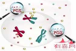 广州代生公司代生过程，广州试管婴儿流程攻略