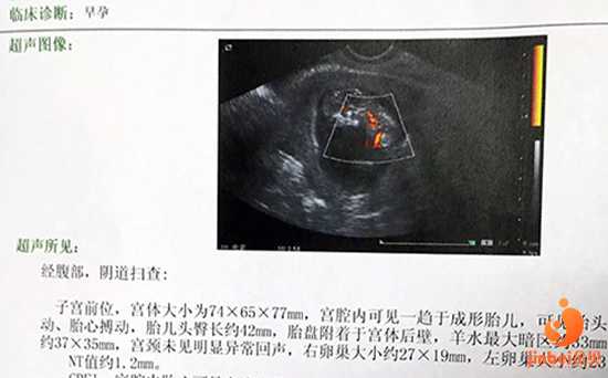 福州早衰供卵,【广州卵巢早衰供卵价格】顺利排卵， 明天官方，备孕三个月，