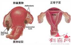 佛山代孕产子机构,广州捐卵试管代孕医院排名，附捐卵试管费用明细！