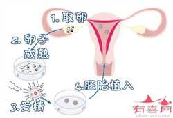 添禧助孕在广州哪里，广州试管助孕中心在哪里做好